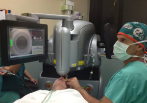 Laser Cataract Surgery in Miami